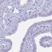 Anti-CGB3 antibody produced in rabbit Prestige Antibodies® Powered by Atlas Antibodies, affinity isolated antibody, buffered aqueous glycerol solution