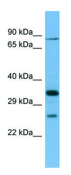 Anti-SLC6A9 (N-terminal) antibody produced in rabbit affinity isolated antibody