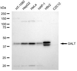 Anti GALT Antibody, clone 23GB5820, Rabbit Monoclonal clone 23GB5820, recombinant rabbit monoclonal, expressed in HEK293 cells