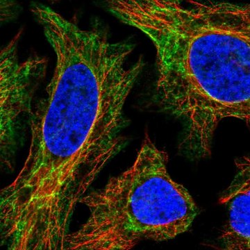 Anti-EPPK1 antibody produced in rabbit Prestige Antibodies&#174; Powered by Atlas Antibodies, affinity isolated antibody