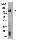 Anti-Glutamate Receptor Delta 1/2 Antibody from rabbit, purified by affinity chromatography