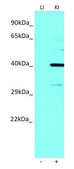 Anti-MACROD1 (N-terminal) antibody produced in rabbit affinity isolated antibody