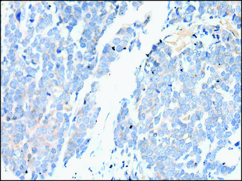 Anti-SMC2 affinity isolated antibody