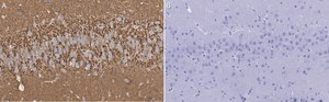 Anti-Synaptophysin Antibody, clone 2B21, ZooMAb® Rabbit Monoclonal recombinant, expressed in HEK 293 cells