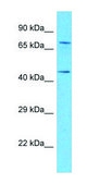 Anti-LTBR (C-terminal) antibody produced in rabbit affinity isolated antibody