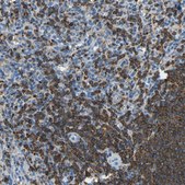 Anti-ARHGAP45 antibody produced in rabbit Prestige Antibodies® Powered by Atlas Antibodies, affinity isolated antibody, buffered aqueous glycerol solution