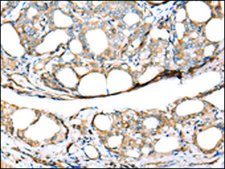 Anti-KCTD16 affinity isolated antibody