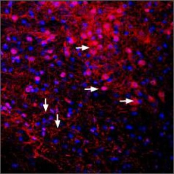 Anti-Potassium Channel KIR3.2 (GIRK2) antibody produced in rabbit affinity isolated antibody, lyophilized powder