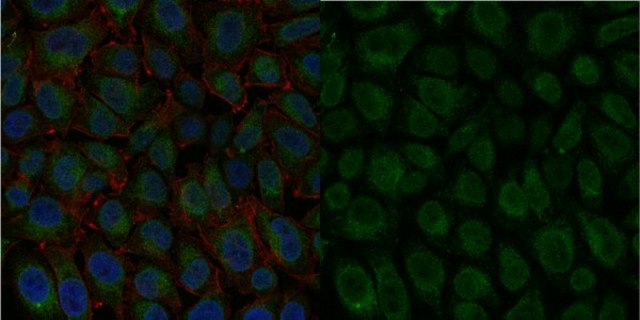 Anti-Integrin &#946;1 Antibody, activated, clone HUTS-4, Alexa Fluor&#8482; 488 Conjugate clone HUTS-4, from mouse, ALEXA FLUOR&#8482; 488