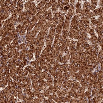 Anti-CORO1C antibody produced in rabbit Prestige Antibodies&#174; Powered by Atlas Antibodies, affinity isolated antibody, buffered aqueous glycerol solution