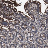 Anti-DFNA5 antibody produced in rabbit Prestige Antibodies® Powered by Atlas Antibodies, affinity isolated antibody, buffered aqueous glycerol solution