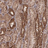 Anti-EIF4ENIF1 antibody produced in rabbit Ab2, Prestige Antibodies® Powered by Atlas Antibodies, affinity isolated antibody, buffered aqueous glycerol solution