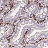 Anti-MEIS1 antibody produced in rabbit Prestige Antibodies® Powered by Atlas Antibodies, affinity isolated antibody, buffered aqueous glycerol solution