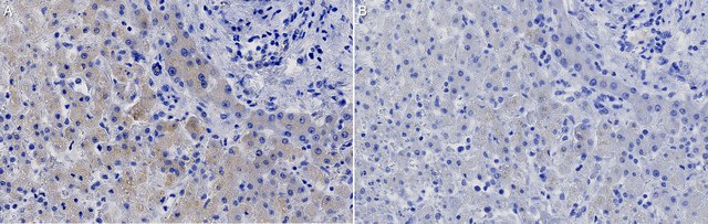 Anti-ApoB Antibody, clone MB47 ZooMAb&#174; Mouse Monoclonal recombinant, expressed in HEK 293 cells