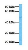Anti-PNPLA3 antibody produced in rabbit affinity isolated antibody