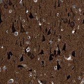 Anti-NUDCD3 antibody produced in rabbit Prestige Antibodies® Powered by Atlas Antibodies, affinity isolated antibody, buffered aqueous glycerol solution, Ab2