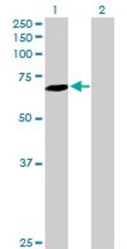 Anti-SLC27A6 antibody produced in mouse purified immunoglobulin, buffered aqueous solution