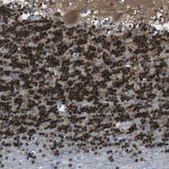 Anti-CAMK4 antibody produced in rabbit affinity isolated antibody, Prestige Antibodies&#174; Powered by Atlas Antibodies, buffered aqueous glycerol solution