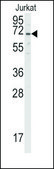 Anti-ARMC6 (center) antibody produced in rabbit saturated ammonium sulfate (SAS) precipitated, buffered aqueous solution