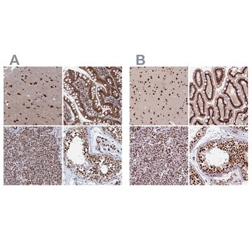 Anti-CTB-50L17.10 antibody produced in rabbit Prestige Antibodies® Powered by Atlas Antibodies, affinity isolated antibody, buffered aqueous glycerol solution
