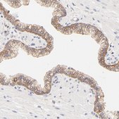 Anti-PTK7 antibody produced in rabbit Prestige Antibodies® Powered by Atlas Antibodies, affinity isolated antibody, buffered aqueous glycerol solution