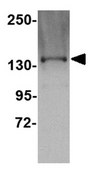 Anti-TTBK1 Antibody from rabbit, purified by affinity chromatography