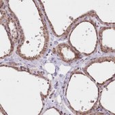 Anti-FCHO2 antibody produced in rabbit Prestige Antibodies® Powered by Atlas Antibodies, affinity isolated antibody, buffered aqueous glycerol solution