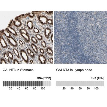 Anti-GALNT3 antibody produced in rabbit Prestige Antibodies&#174; Powered by Atlas Antibodies, affinity isolated antibody, buffered aqueous glycerol solution