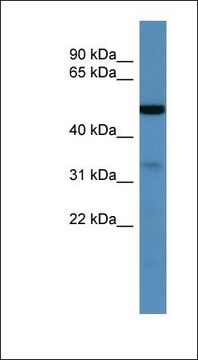 Anti-ZDHHC3 antibody produced in rabbit affinity isolated antibody