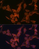 Anti-ULK3 Antibody, clone 5Z7Z6, Rabbit Monoclonal