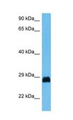 Anti-PDX1, (N-terminal) antibody produced in rabbit affinity isolated antibody