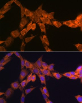 Anti-67kDa Laminin Receptor Antibody, clone 2Q8Q6, Rabbit Monoclonal