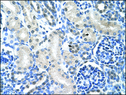 Anti-LOR IgG fraction of antiserum