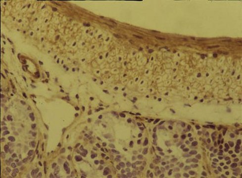 抗整合素 &#945;5&#946;1抗体（克隆BMC5） ascites fluid, clone BMC5, Chemicon&#174;