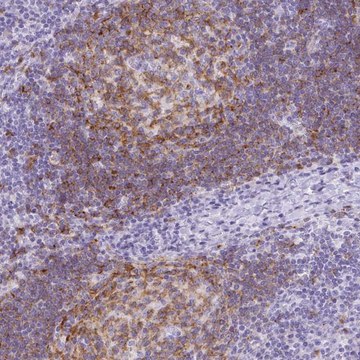 Anti-TAS2R39 antibody produced in rabbit Prestige Antibodies&#174; Powered by Atlas Antibodies, affinity isolated antibody, buffered aqueous glycerol solution