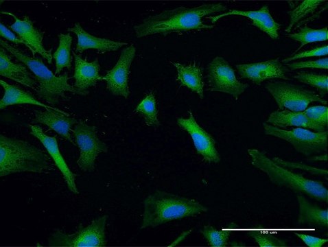 Anti-SH3GLB2 antibody produced in mouse IgG fraction of antiserum, buffered aqueous solution