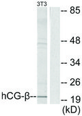 Anti-HCG β antibody produced in rabbit affinity isolated antibody