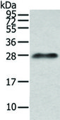 Anti-Lambda Light chain affinity isolated antibody