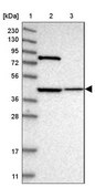 Anti-DHRS13 antibody produced in rabbit Prestige Antibodies® Powered by Atlas Antibodies, affinity isolated antibody, buffered aqueous glycerol solution
