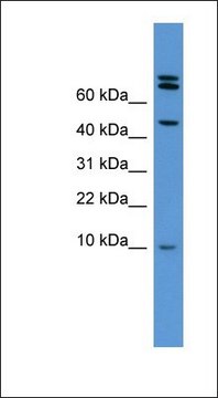 Anti-BMP2 antibody produced in rabbit affinity isolated antibody