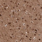 Anti-TECPR2 antibody produced in rabbit Prestige Antibodies® Powered by Atlas Antibodies, affinity isolated antibody, buffered aqueous glycerol solution