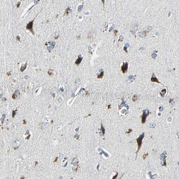 Anti-SLC2A13 antibody produced in rabbit Prestige Antibodies&#174; Powered by Atlas Antibodies, affinity isolated antibody, buffered aqueous glycerol solution