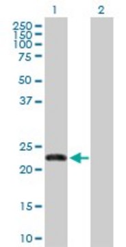 Anti-FBXO36 antibody produced in rabbit purified immunoglobulin, buffered aqueous solution