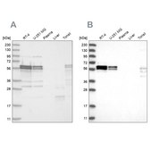 Anti-ZC3H15 antibody produced in rabbit Prestige Antibodies® Powered by Atlas Antibodies, affinity isolated antibody, buffered aqueous glycerol solution, ab3