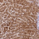 Anti-ANKS3 antibody produced in rabbit Prestige Antibodies® Powered by Atlas Antibodies, affinity isolated antibody, buffered aqueous glycerol solution