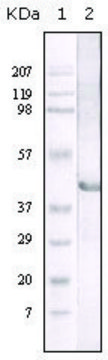 Monoclonal Anti-LIPA antibody produced in mouse clone 9G7F12, ascites fluid