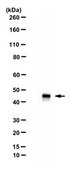 Anti-ALKBH1 Antibody from rabbit, purified by affinity chromatography
