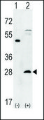 Anti-CDCA8 (center) antibody produced in rabbit Ig fraction of antiserum, buffered aqueous solution