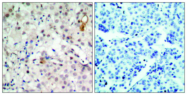 Anti-HER2 antibody produced in rabbit affinity isolated antibody