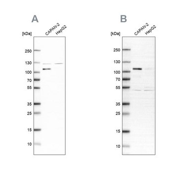 Anti-SP1 antibody produced in rabbit Prestige Antibodies® Powered by Atlas Antibodies, affinity isolated antibody, buffered aqueous glycerol solution